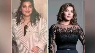 اشكال الفنانين قبل وبعد عمليات التجميل ، تامر حسني ،اصاله ، احلام ، غاده عبد الرازق ، توم كروز ..