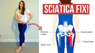 The Glute Weakness Thats Triggering Your Sciatica. How To Fix This.
