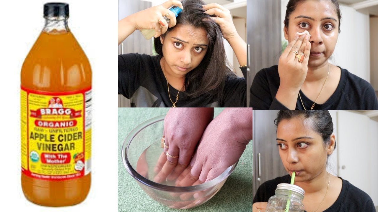 Can You Cure Your Acne with Apple Cider Vinegar?