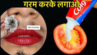 सिर्फ़ 5 मिनट में अनचाहे बालों को ऐसे हटाएगा कि दोबारा कभी वापस नहीं आएंगे Remove Unwanted Hair