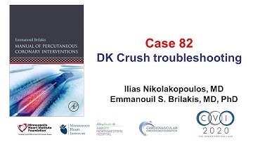 Case 82: PCI Manual - DK crush troubleshooting
