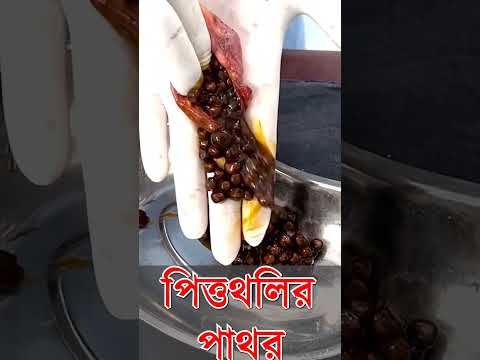 ভিডিও: পিথি মিষ্টি আলু খাওয়া কি নিরাপদ?