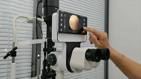 Digital Imaging Module Phonto for slit lamp