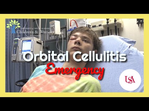 Video: Er preseptal cellulitt smertefullt?