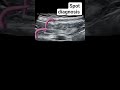 Spot diagnosis Kindly leave your comment #ultrasound