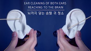ASMR Homemade insomnia treatment Clean the ears that reach the brain 🤤
