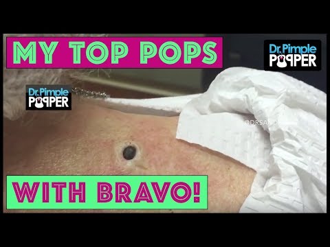Dr. Sandra Lee Discusses Her TOP Pops With BravoTV.com