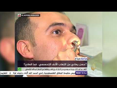 فيديو: كيفية علاج جرح في أنفك (بالصور)