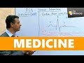 Dr srinath chandramani of drmentorscom discussing ecg topic  neetpg