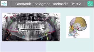 Panoramic Radiograph Landmarks Tutorial  Part 2