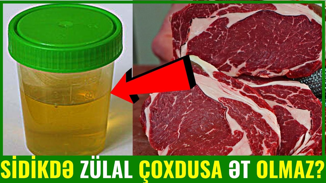 Hamiləlikdə Sidikdə Zülal Çoxdursa Bunları Yemək Olmaz!