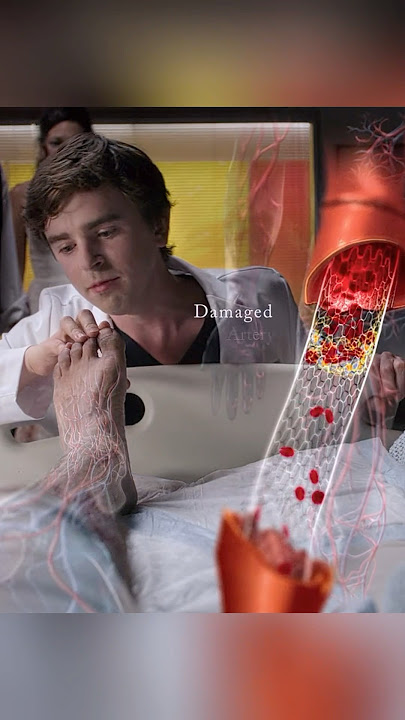 Dr. Shaun discovered that the patient’s leg was dying. #movie #film #doctor #shorts #series