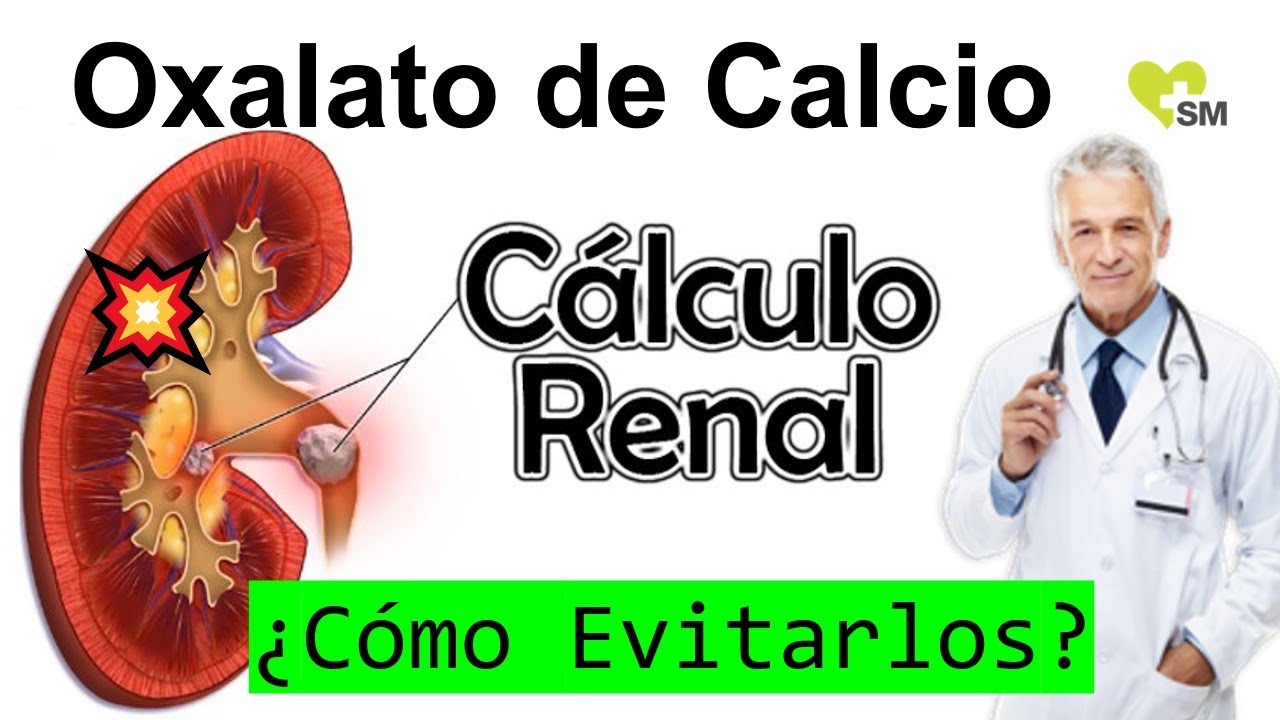 Prevención del Cólico Renal por Oxalato de Calcio, Recomendaciones ...