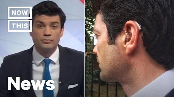BBC Anchor Lewis Vaughan Jones Became Partially De...