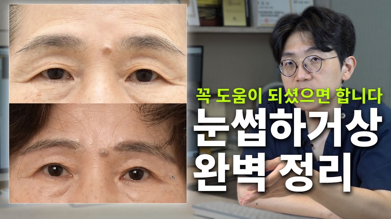 눈썹하거상 정말 꼭 필요한 내용입니다 (회복기간,부작용,흉터,성공여부,효과)