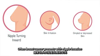 About Breast Cancer Part 1