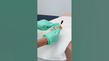 Make Sure To Use Skin Prep And Ensure The Drainage Container Is Dated Foley Healthcare 