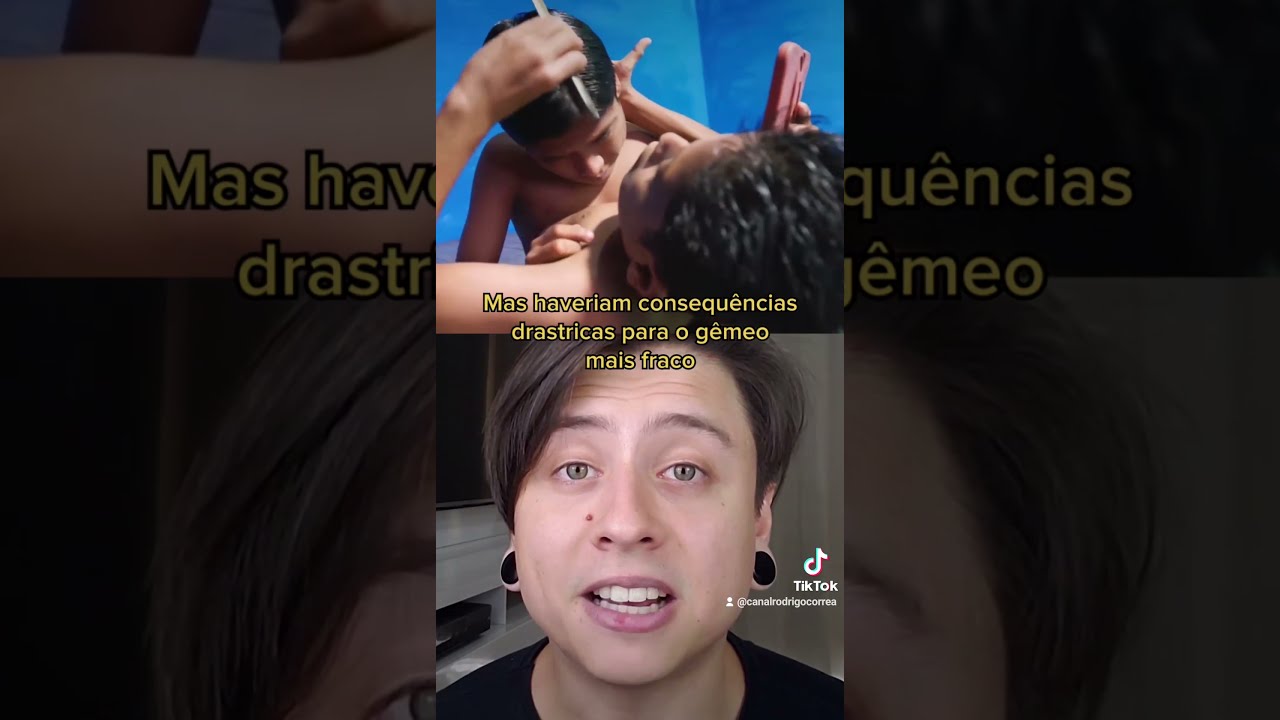 ESSES GÊMEOS SIAMESES NÃO QUEREM SER SEPARADOS! #Shorts