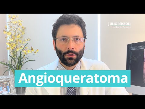 Vídeo: O angioqueratoma de fordyce é contagioso?