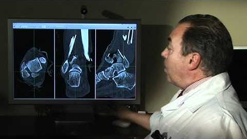 Osirix version française