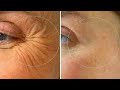 Everyday eye wrinkles massage crows feet 5 minutes massage