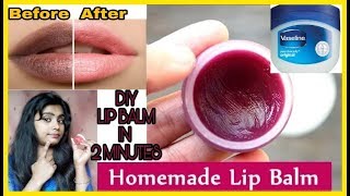 Hi.. 10 winter skin care tips in hindi / sardiyo me /dry --
https://youtu.be/dwq9__l7whw best moisturizer lotion for dry skin,
lips,...