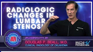 Radiologic Changes in Lumbar Stenosis - Douglas P. Beall, M.D.