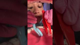 Dentist #asmr #dentistroleplay