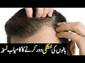 Balon ki khushki hair dandruff ka ilaj  tibe ahlebait part 39  maulana syed ali naqi kazmi