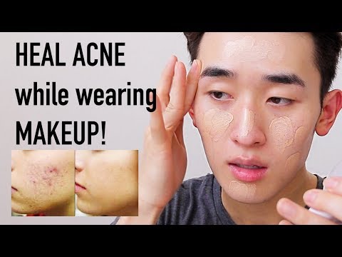 BEST CUSHION Foundations for ACNE-PRONE SKIN! | Ivan Lam