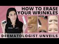 Dermatologist unveils how to treat  prevent wrinkles  wrinkles azimdskincare skincaretips