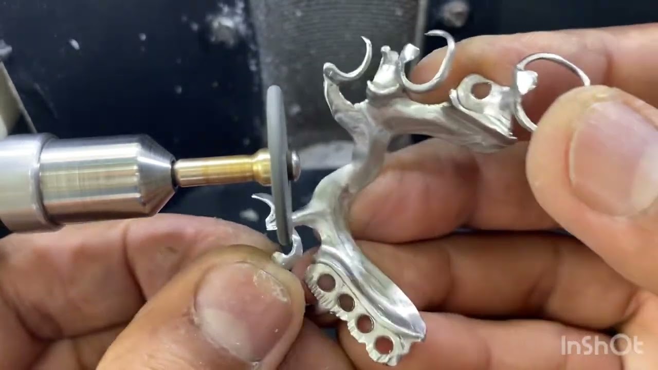 PPR do início ao fim