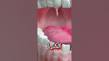 ليه ريحة فمك بتبقي وحشة اول ما تصحي من النوم سبب مقرف جدا 