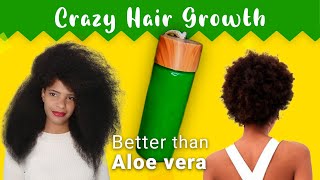 Only One Ingredient &amp; Your Hair Will Grow Like Crazy | Better than Aloe Vera 😱