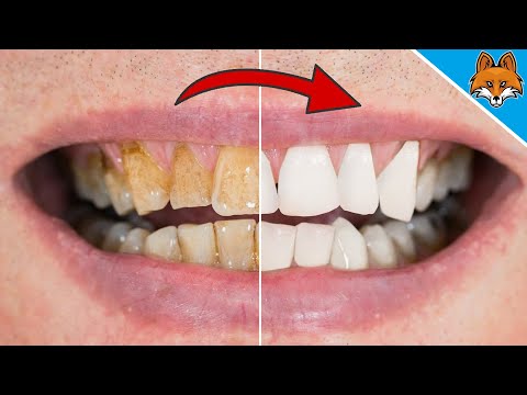 You will NOT believe how EASY you can WHITEN your Teeth 💥