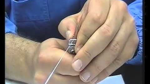 Modeling and Bending Wires   Sectional for canine retrusion