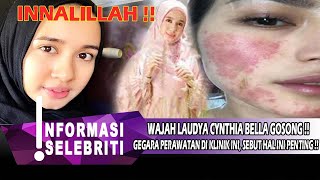 Download Lagu SALAH PILIH KLINIK PERAWATAN,WAJAH LAUDYA CYNTHIA BELLA GOSONG,INI KRONOLOGINYA|gosip artis hari ini MP3 Download Lagu SALAH PILIH KLINIK PERAWATAN,WAJAH LAUDYA CYNTHIA BELLA GOSONG,INI KRONOLOGINYA|gosip artis hari ini MP3