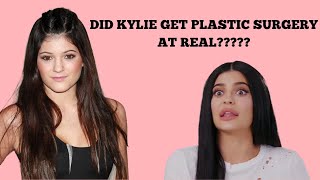 Did Kylie Jenner get plastic surgery at real?