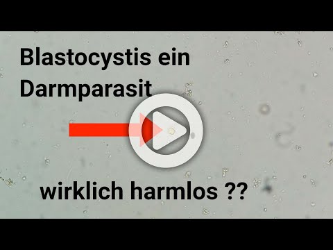 Video: Warum ist Giardiasis in Entwicklungsländern häufiger?