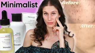 Best Be Minimalist Products For Acne (Available in US & UK!)