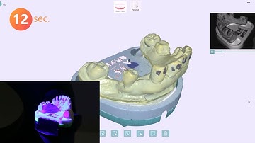 Dental Lab Scanner | LS100