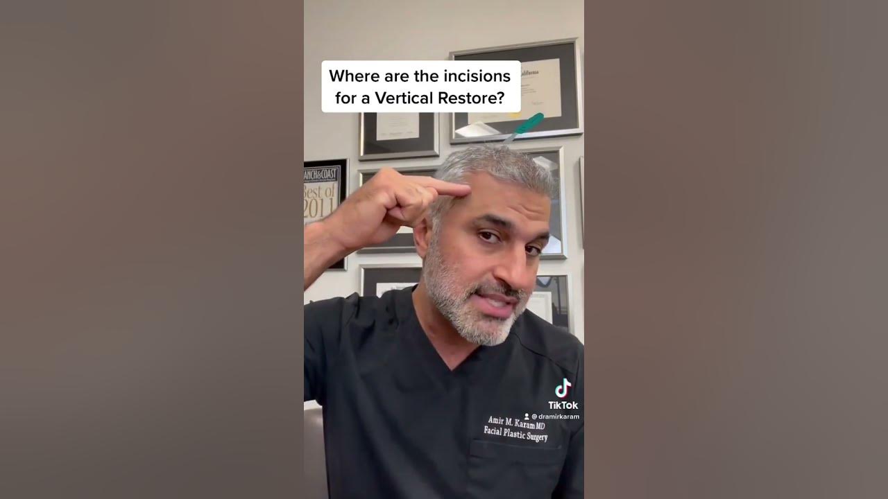 The Hidden Incisions of a Vertical Restore Facelift YouTube