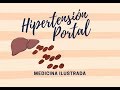 Hipertensión Portal