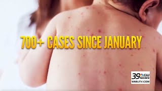 CDC issues urgent measles warning ahead of summer travel