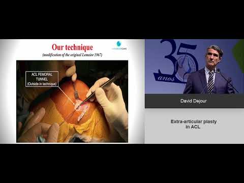 Dr David DEJOUR - Extra articular plasty in ACL