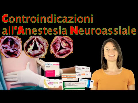 Video: Quando è stata la prima anestesia neuroassiale?