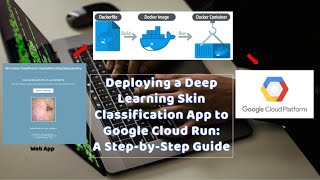 Deploying a Deep Learning Skin Classification App to Google Cloud Run: A Step-by-Step Guide | AMD64