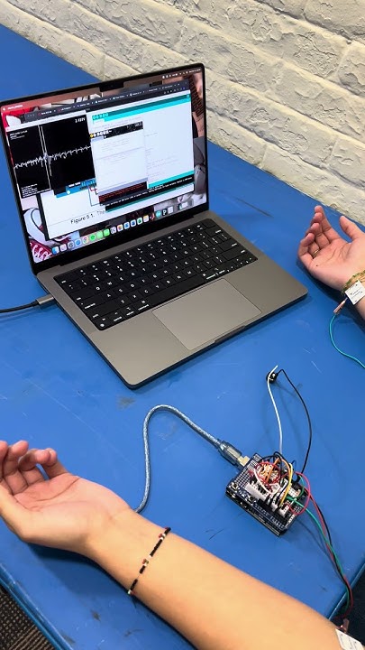 ECG LAB using Arduino Uno - YouTube