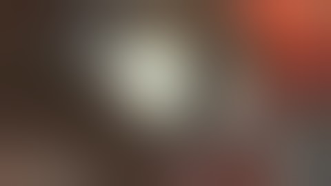 Trigeminal neuralgia-MVD-groove/dent  on the nerve by the  vessel-dr suresh dugani/HUBLI/INDIA