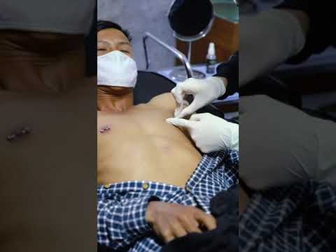 Nipple Piercing - Tindik Puting | INDONESIA #1 PIERCING SHOP